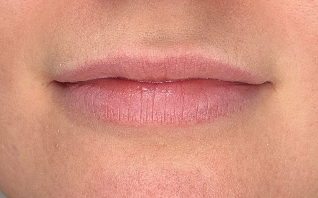Powder Lips, vorher
